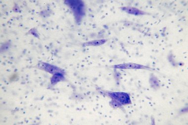 Mikroskopla beyindeki nöronlar. (Yumuşak odaklanma)