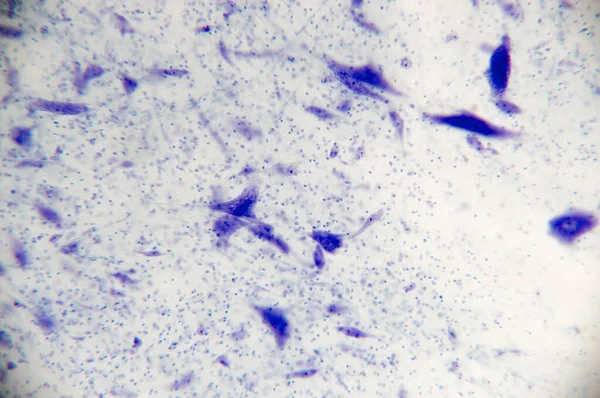 Neuronen Hersenen Door Microscoop Zachte Focus — Stockfoto