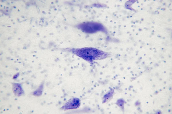 Neuronen Hersenen Door Microscoop Zachte Focus — Stockfoto