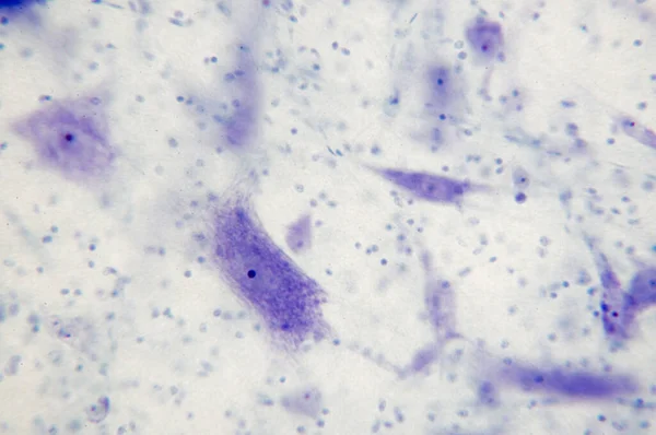 Les Neurones Cerveau Microscope Mise Point Douce — Photo