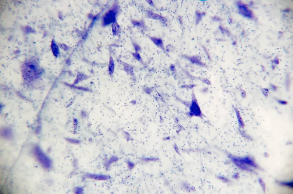 显微镜下的脑神经细胞 软性重点 — 图库照片