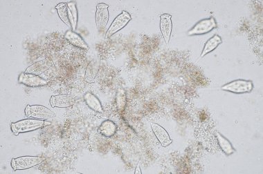 Yaşayan Vorticella mikroskop altında bir protozoan cinsidir..                             