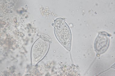Yaşayan Vorticella mikroskop altında bir protozoan cinsidir..                             