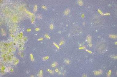 Euglena tek hücreli kırbaçlanmış ökaryotların bir cinsidir..