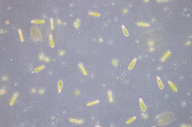 Euglena tek hücreli kırbaçlanmış ökaryotların bir cinsidir..