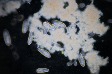 Paramesyum, tatlı su, tuzlu su ve deniz ortamlarında yaygın olan tek hücreli protozoa cinsidir ve genellikle durgun havzalar ve havuzlarda çoktur..