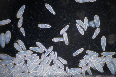 Paramesyum, tatlı su, tuzlu su ve deniz ortamlarında yaygın olan tek hücreli protozoa cinsidir ve genellikle durgun havzalar ve havuzlarda çoktur..