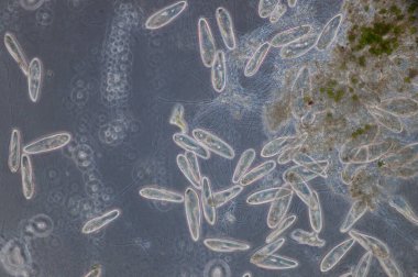 Paramesyum, tatlı su, tuzlu su ve deniz ortamlarında yaygın olan tek hücreli protozoa cinsidir ve genellikle durgun havzalar ve havuzlarda çoktur..