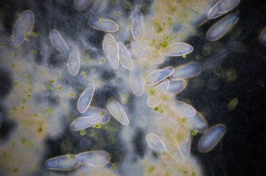 Paramesyum, tatlı su, tuzlu su ve deniz ortamlarında yaygın olan tek hücreli protozoa cinsidir ve genellikle durgun havzalar ve havuzlarda çoktur..