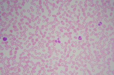 Mikroskop altında kan hücreleri