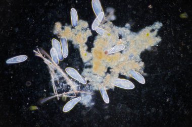 Paramesyum, tatlı su, tuzlu su ve deniz ortamlarında yaygın olan tek hücreli protozoa cinsidir ve genellikle durgun havzalar ve havuzlarda çoktur..