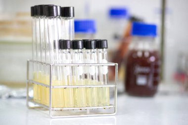 Bakteri kültürü için test tüpü