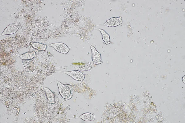 Living Vorticella Est Genre Protozoaires Sous Microscop View — Photo