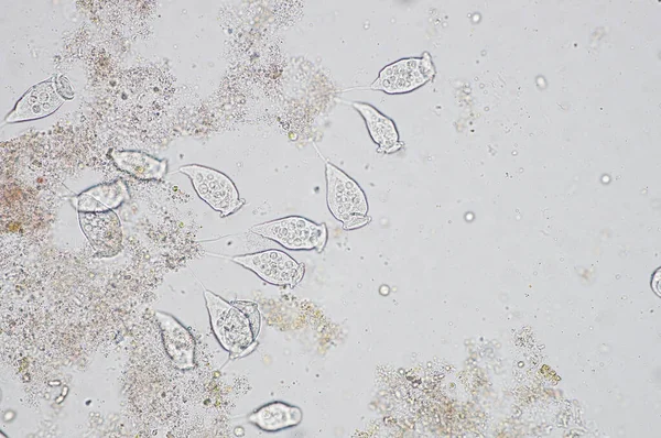 Living Vorticella Género Protozoos Bajo Vista Microscópica — Foto de Stock