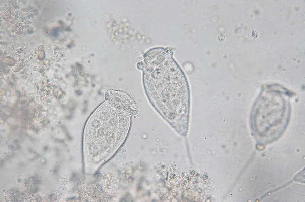 Living Vorticella Genere Protozoi Sotto Microscopio — Foto Stock