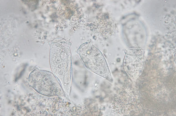 Élő Vorticella Protozoaiak Nemzetsége Mikroszkopikus Szemmel — Stock Fotó
