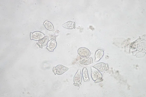 Vorticella Protozoaiak Nemzetsége Mikroszkopikus Megfigyelés Alatt — Stock Fotó