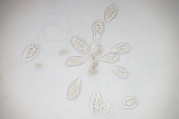 ヴォルティチェラ Vorticella 顕微鏡観察下の原生動物の属である — ストック写真