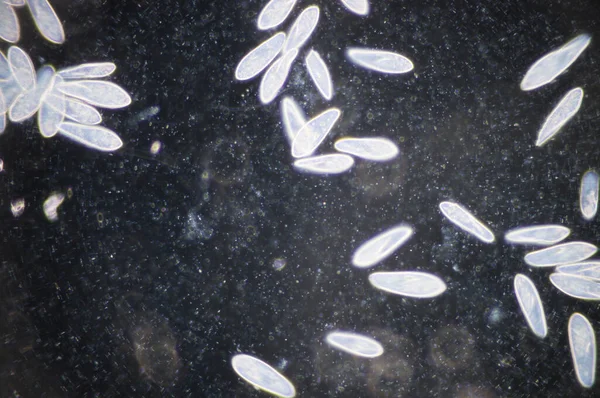 Paramecium Egy Nemzetség Egysejtű Ciliated Protozoa Paramecia Széles Körben Elterjedt — Stock Fotó