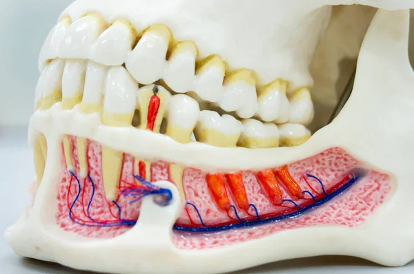 Closeup Modelo Dente Dental Elenco Mostrando Decadência Dor Invólucro Esmalte — Fotografia de Stock