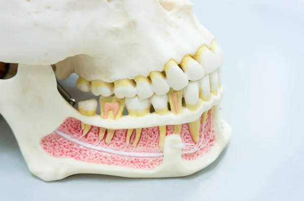 Closeup Modelo Dente Dental Elenco Mostrando Decadência Dor Invólucro Esmalte — Fotografia de Stock