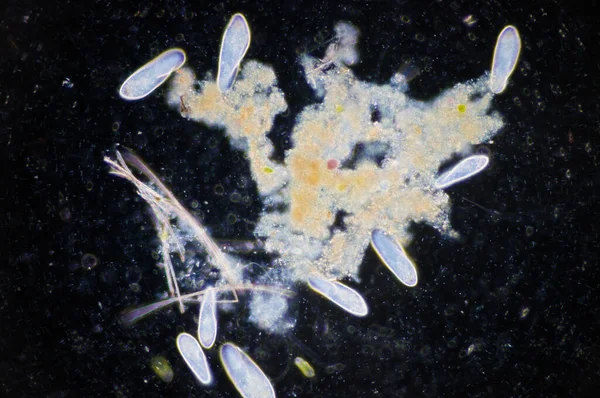 Парамецій Paramecium Рід Одноклітинних Циліованих Протозоа Paramecia Поширений Прісній Воді — стокове фото