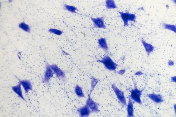 Нейронные Клетки Мозга Микроскопом — стоковое фото