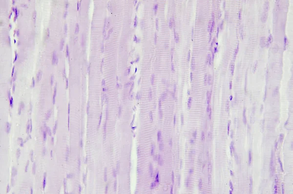 Histologie Van Skeletspieren Onder Microscoop — Stockfoto