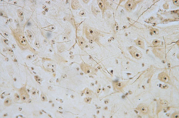Нейрони Спинного Мозку Під Мікроскопом — стокове фото