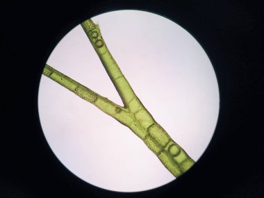 Mikroskop altında su bitkisi hücresi