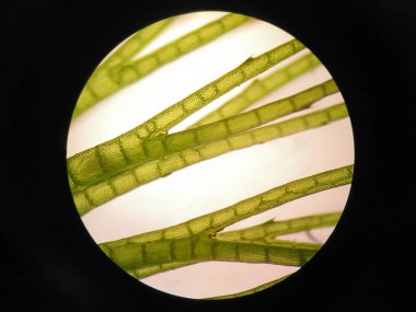 Mikroskop altında su bitkisi hücresi