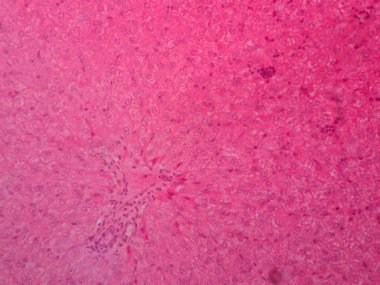 Mikroskop altında insan karaciğer dokusu