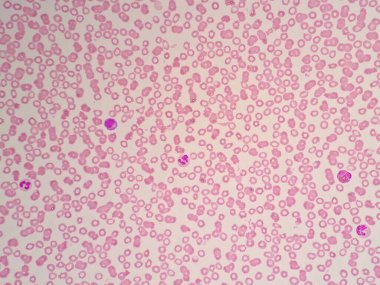 Mikroskop altında insan kan hücreleri