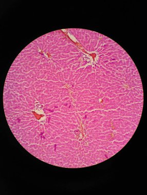 Mikroskop altında insan karaciğer dokusu