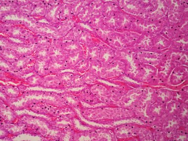 Mikroskop altında insan böbreği tarihi