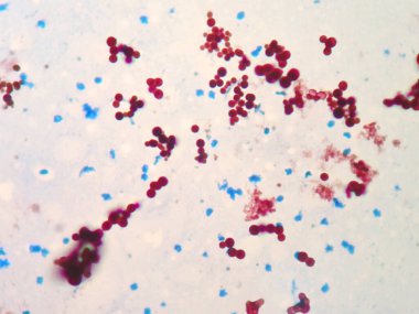Mycobacterium balıklarda ya da evcil hayvanlarda tüberküloza neden olan bakteriler içindir.