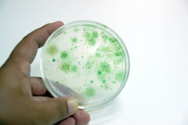 Kültür orta plakalı mavi yeşil alg kolonisi, Mikrobiyoloji.