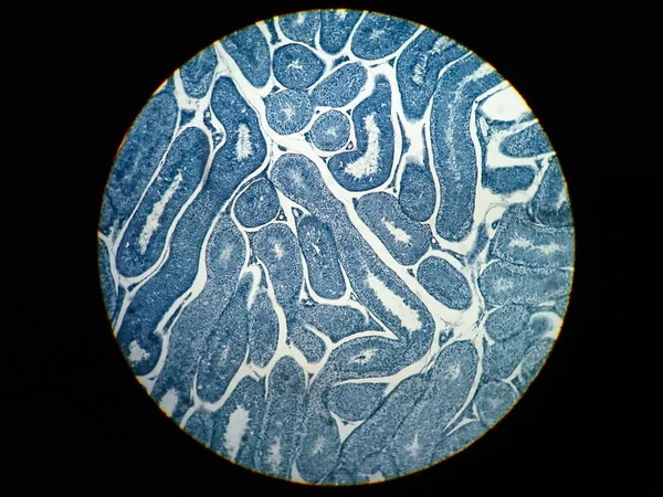 Corte Transversal Testículo Humano Bajo Vista Del Microscopio Muestra Espermatogonia —  Fotos de Stock