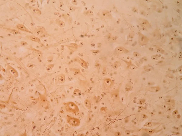 显微镜下脊髓中的人神经细胞 — 图库照片