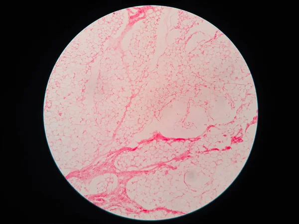 Tkanki Tłuszczowej Człowieka Pod Mikroskopem Widok — Zdjęcie stockowe