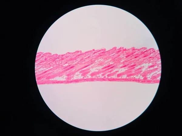 Corte Transversal Tecido Pele Humana Sob Visão Microscópica — Fotografia de Stock