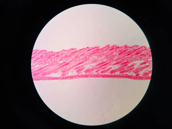Corte Transversal Tejido Piel Humana Bajo Microscopio Ver — Foto de Stock