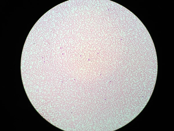 显微镜下的人造血细胞 — 图库照片