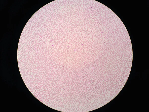 Emberi Vérsejtek Mikroszkóp Alatt — Stock Fotó