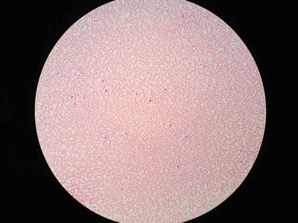 顕微鏡下のヒト血液細胞 — ストック写真