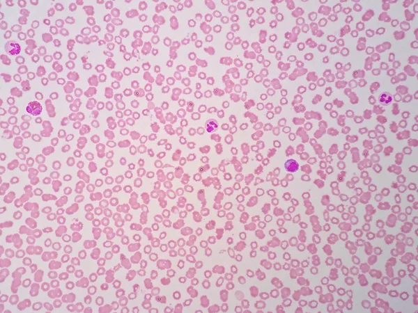 Células Sanguíneas Humanas Sob Visão Microscópica — Fotografia de Stock