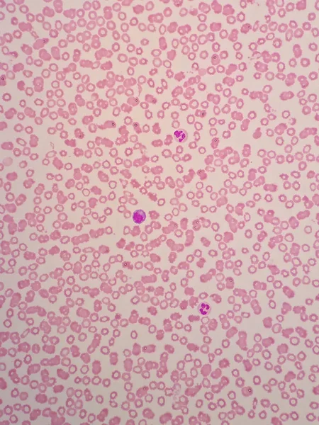Emberi Vérsejtek Mikroszkóp Alatt — Stock Fotó