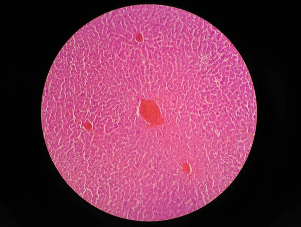 Tecido Hepático Humano Sob Visão Microscópica — Fotografia de Stock