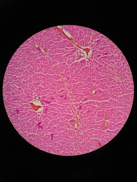 Ткани Печени Человека Микроскопом — стоковое фото