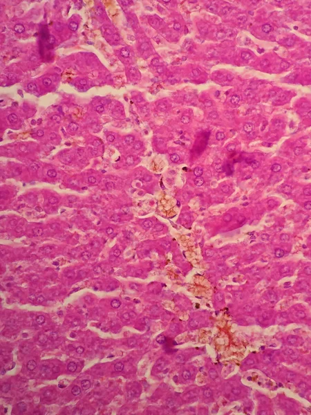 Тканини Печінки Людини Під Мікроскопом — стокове фото